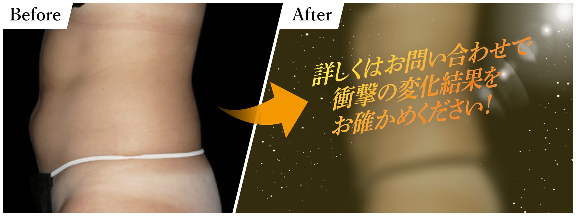 詳しくはお問い合わせで衝撃の変化結果をお確かめください！